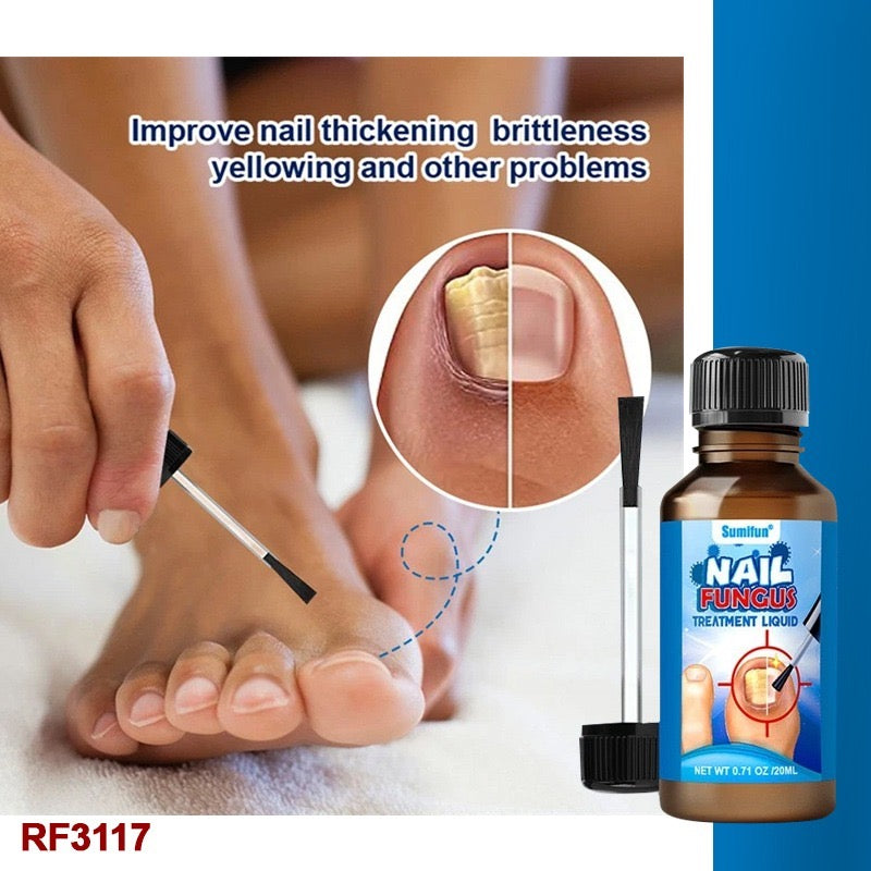 Sumifun - Nail Fungus Treatment Liquid (Original)