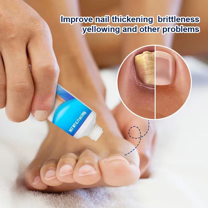 Sumifun - Nail Fungus Treatment (Original) UAE