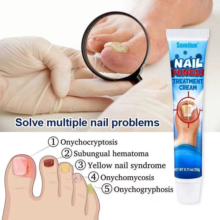 Sumifun - Nail Fungus Treatment Cream (Original) UAE